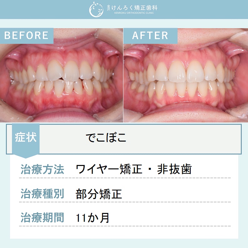 ビフォーアフターで見る治療の成果