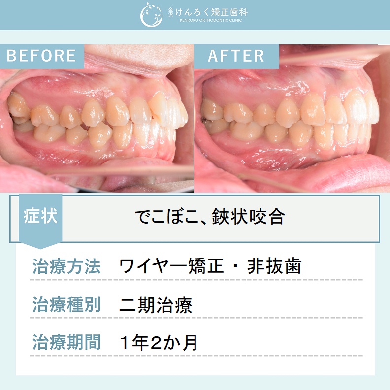 ビフォーアフターで見る治療の成果