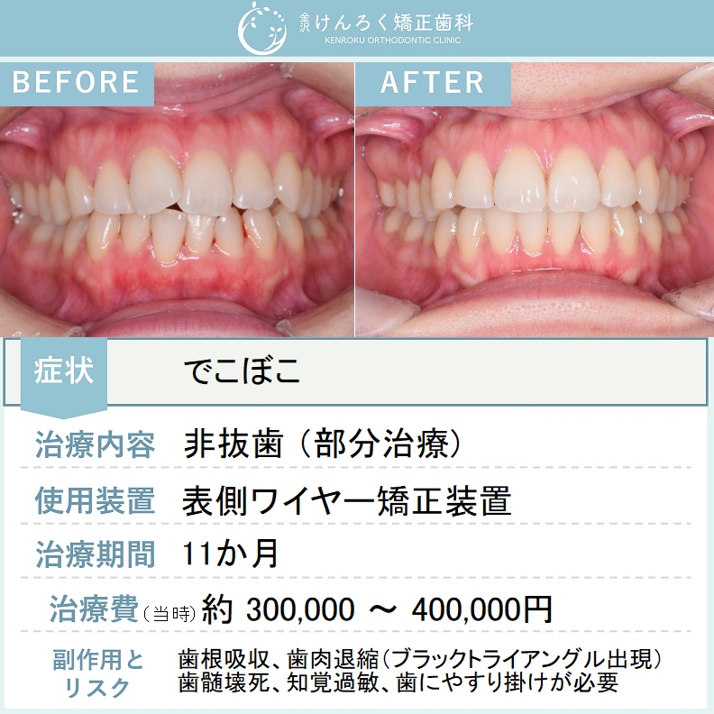 ビフォーアフターで見る治療の成果