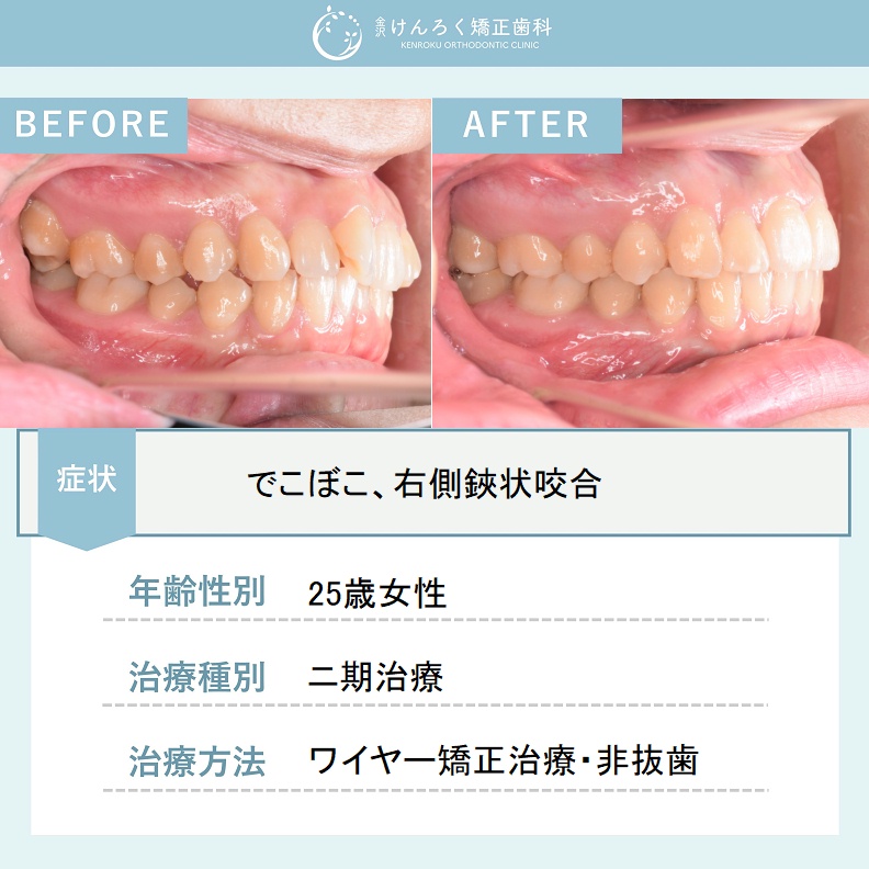 認定医監修の矯正まめ知識・コラム
