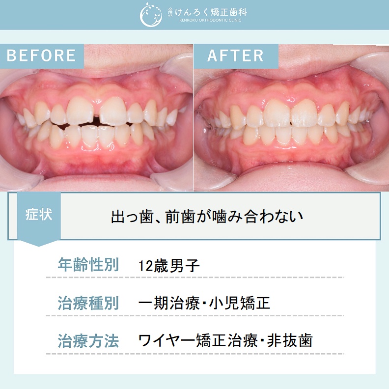 ビフォーアフターで見る治療の成果