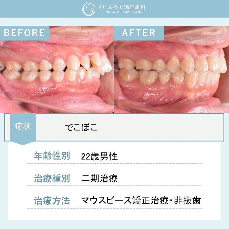 ビフォーアフターで見る治療の成果