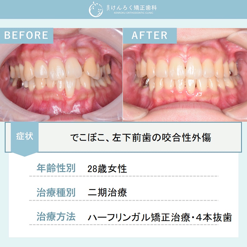 認定医監修の矯正まめ知識・コラム