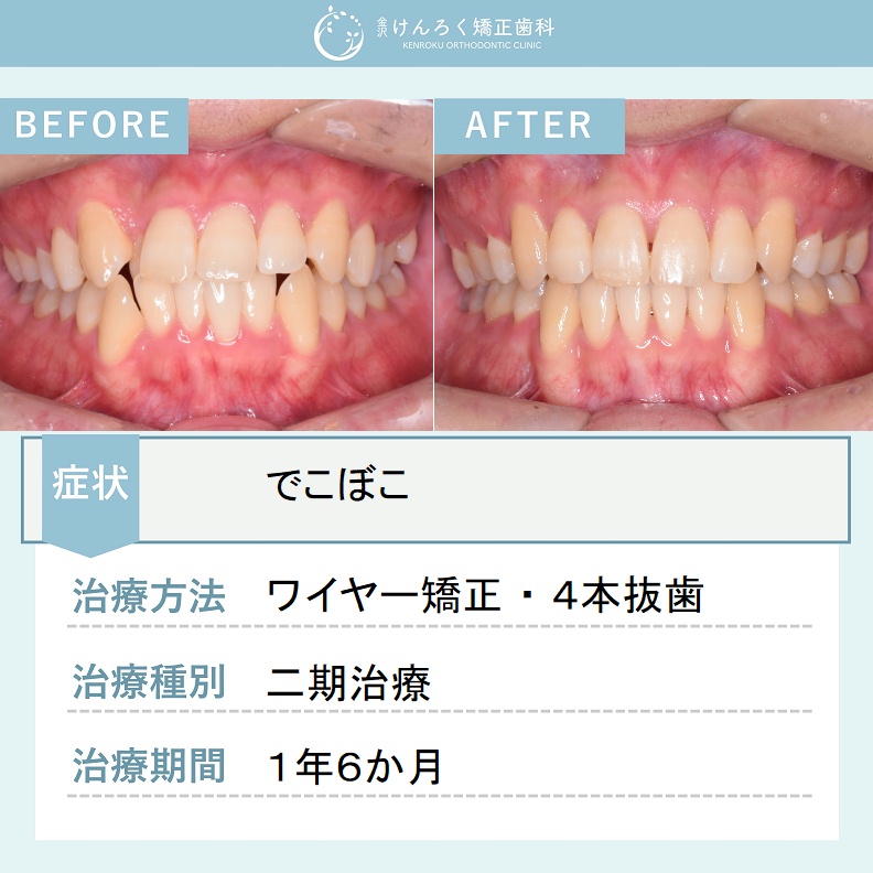 ビフォーアフターで見る治療の成果